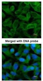 TCP-1 epsilon Antibody in Immunocytochemistry (ICC/IF)