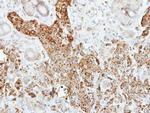 PNLIP Antibody in Immunohistochemistry (Paraffin) (IHC (P))