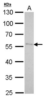 PNLIP Antibody in Western Blot (WB)