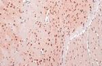 OGT Antibody in Immunohistochemistry (Paraffin) (IHC (P))