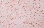 OGT Antibody in Immunohistochemistry (Paraffin) (IHC (P))