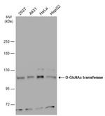 OGT Antibody in Western Blot (WB)