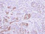 Villin Antibody in Immunohistochemistry (Paraffin) (IHC (P))