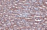 Villin Antibody in Immunohistochemistry (Paraffin) (IHC (P))