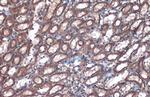 Villin Antibody in Immunohistochemistry (Paraffin) (IHC (P))