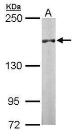 DIP2B Antibody in Western Blot (WB)