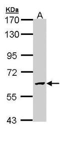 GALNS Antibody in Western Blot (WB)