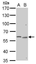 GALNS Antibody in Western Blot (WB)