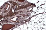 FASN Antibody in Immunohistochemistry (Paraffin) (IHC (P))