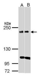 KIDINS220 Antibody in Western Blot (WB)