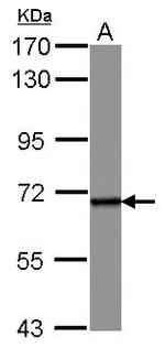 SENP2 Antibody in Western Blot (WB)