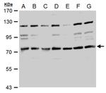 TACC2 Antibody in Western Blot (WB)