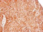 RRAS2 Antibody in Immunohistochemistry (Paraffin) (IHC (P))