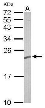 RRAS2 Antibody in Western Blot (WB)