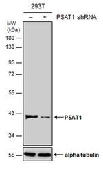 PSAT1 Antibody
