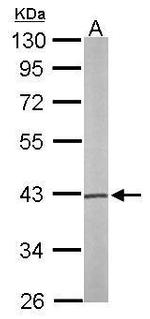 PSAT1 Antibody in Western Blot (WB)