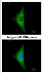 Cytokeratin 20 Antibody in Immunocytochemistry (ICC/IF)