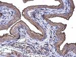 Cytokeratin 20 Antibody in Immunohistochemistry (Paraffin) (IHC (P))