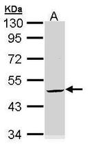 Cytokeratin 20 Antibody in Western Blot (WB)