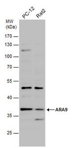 AIP Antibody in Western Blot (WB)