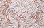 V-ATPase H Antibody in Immunohistochemistry (Paraffin) (IHC (P))