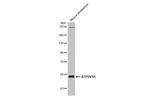 V-ATPase H Antibody in Western Blot (WB)