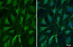 ZC3H12A Antibody in Immunocytochemistry (ICC/IF)