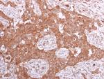 PPA1 Antibody in Immunohistochemistry (Paraffin) (IHC (P))