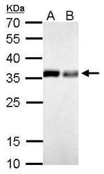 PPA1 Antibody in Western Blot (WB)