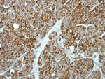 LAMTOR3 Antibody in Immunohistochemistry (Paraffin) (IHC (P))