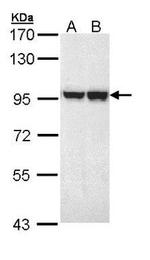 MALT1 Antibody in Western Blot (WB)