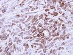 MX1 Antibody in Immunohistochemistry (Paraffin) (IHC (P))