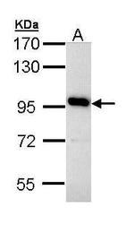 ATP6V0A4 Antibody in Western Blot (WB)