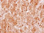 MVD Antibody in Immunohistochemistry (Paraffin) (IHC (P))