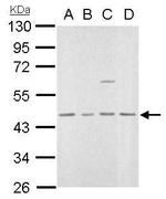 MVD Antibody in Western Blot (WB)