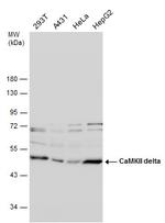 CaMKII delta Antibody in Western Blot (WB)