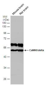 CaMKII delta Antibody in Western Blot (WB)