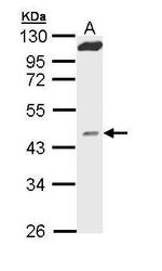 MVD Antibody in Western Blot (WB)