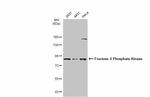 PFKM Antibody in Western Blot (WB)