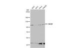 ULK2 Antibody in Western Blot (WB)