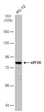 EEF2K Antibody in Western Blot (WB)