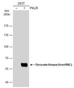 PKLR Antibody in Western Blot (WB)