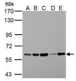 PKLR Antibody in Western Blot (WB)