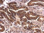 PKN2 Antibody in Immunohistochemistry (Paraffin) (IHC (P))