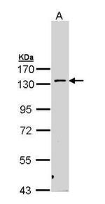 PKN2 Antibody in Western Blot (WB)