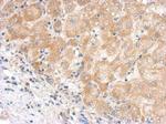 Complement C5 Antibody in Immunohistochemistry (Paraffin) (IHC (P))