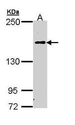 Complement C5 Antibody in Western Blot (WB)