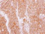 GMFB Antibody in Immunohistochemistry (Paraffin) (IHC (P))