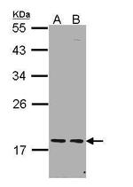 PCNP Antibody in Western Blot (WB)