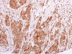 BCL2L12 Antibody in Immunohistochemistry (Paraffin) (IHC (P))